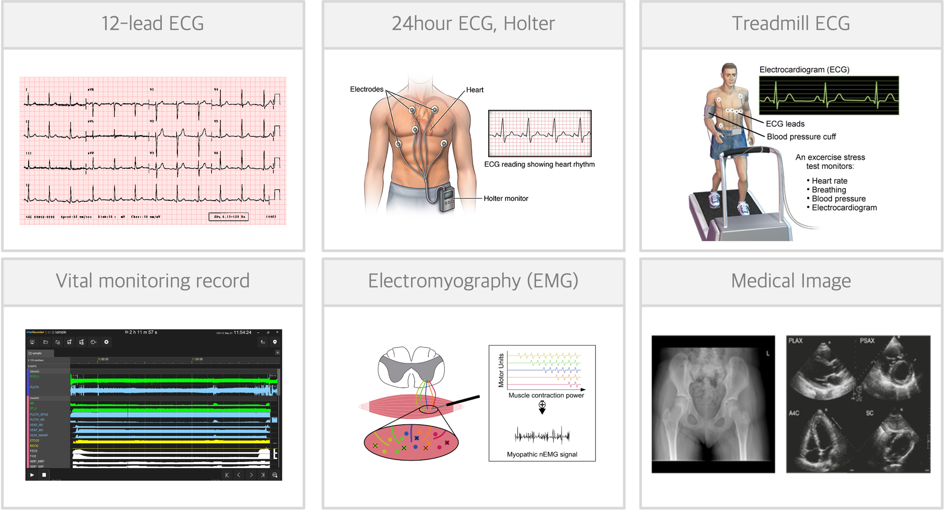 비정형 데이터 예시: 12-lead ECG, 24시간 Holter, 운동부하 Treadmill ECG, Vital monitoring record, EMG, 의료영상