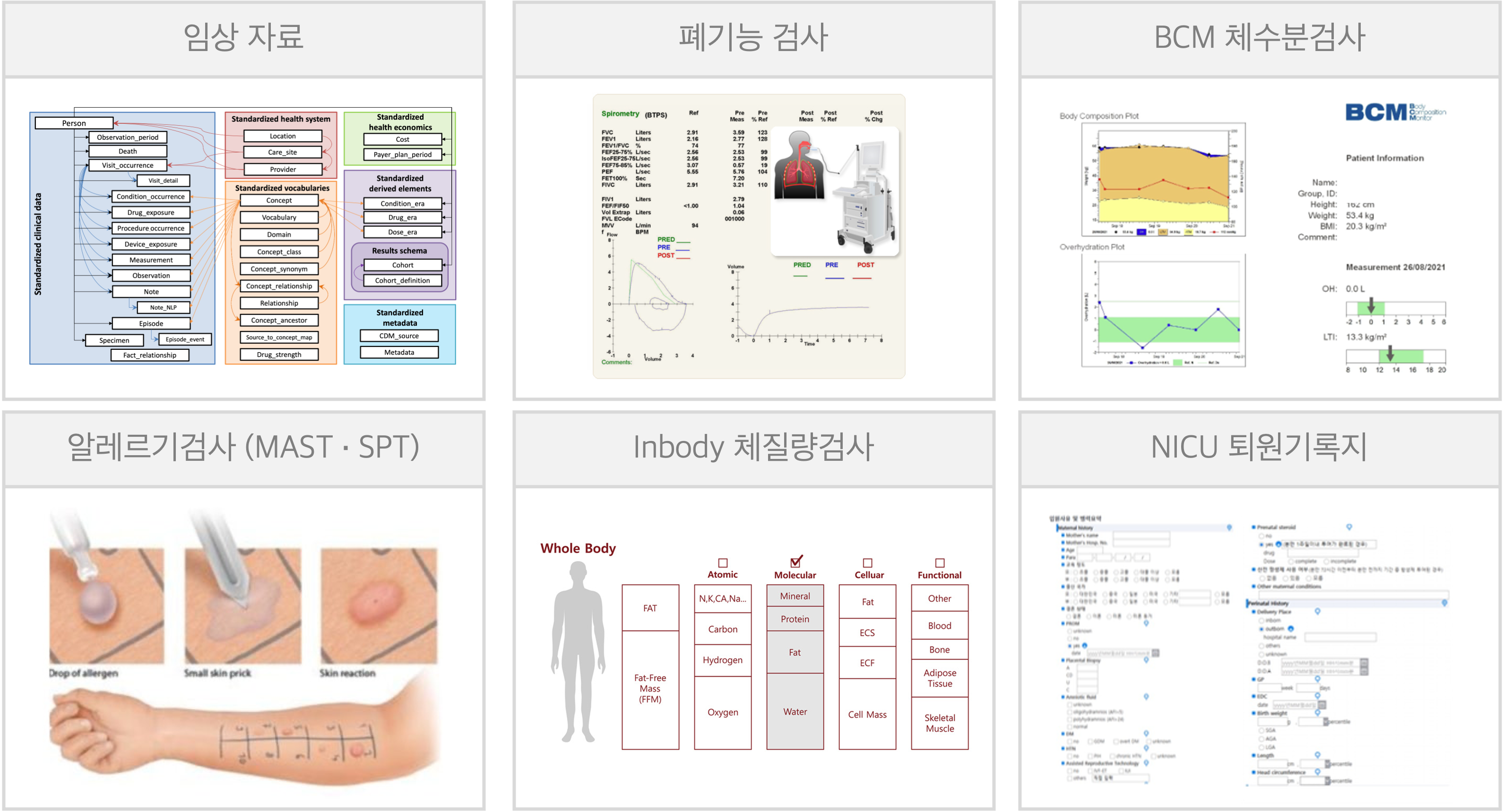 정형 데이터 예시: 임상 자료, 폐기능검사, BCM 체수분검사, 알레르기검사(MAST·SPT), Inbody 체질량검사, NICU 퇴원기록지