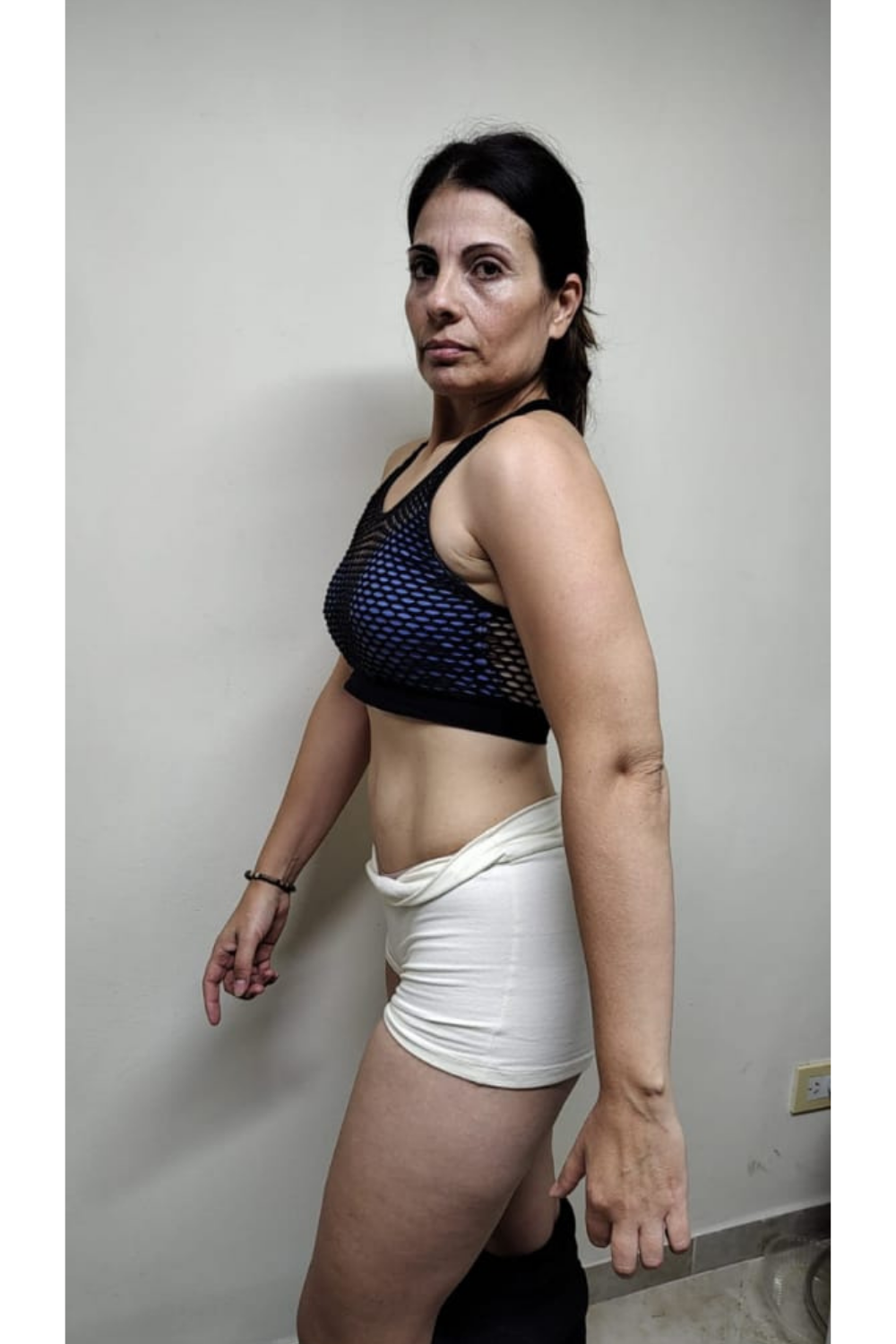 Transformación mujer - Antes (perfil)