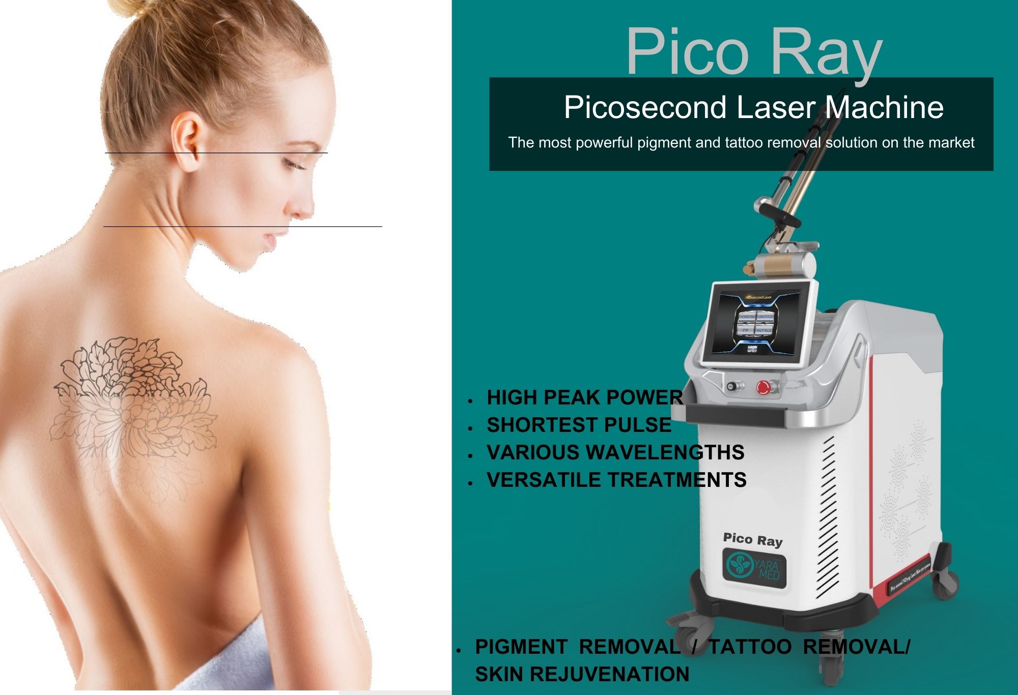 PICO RAY Picosecond Laser Machine - Main View