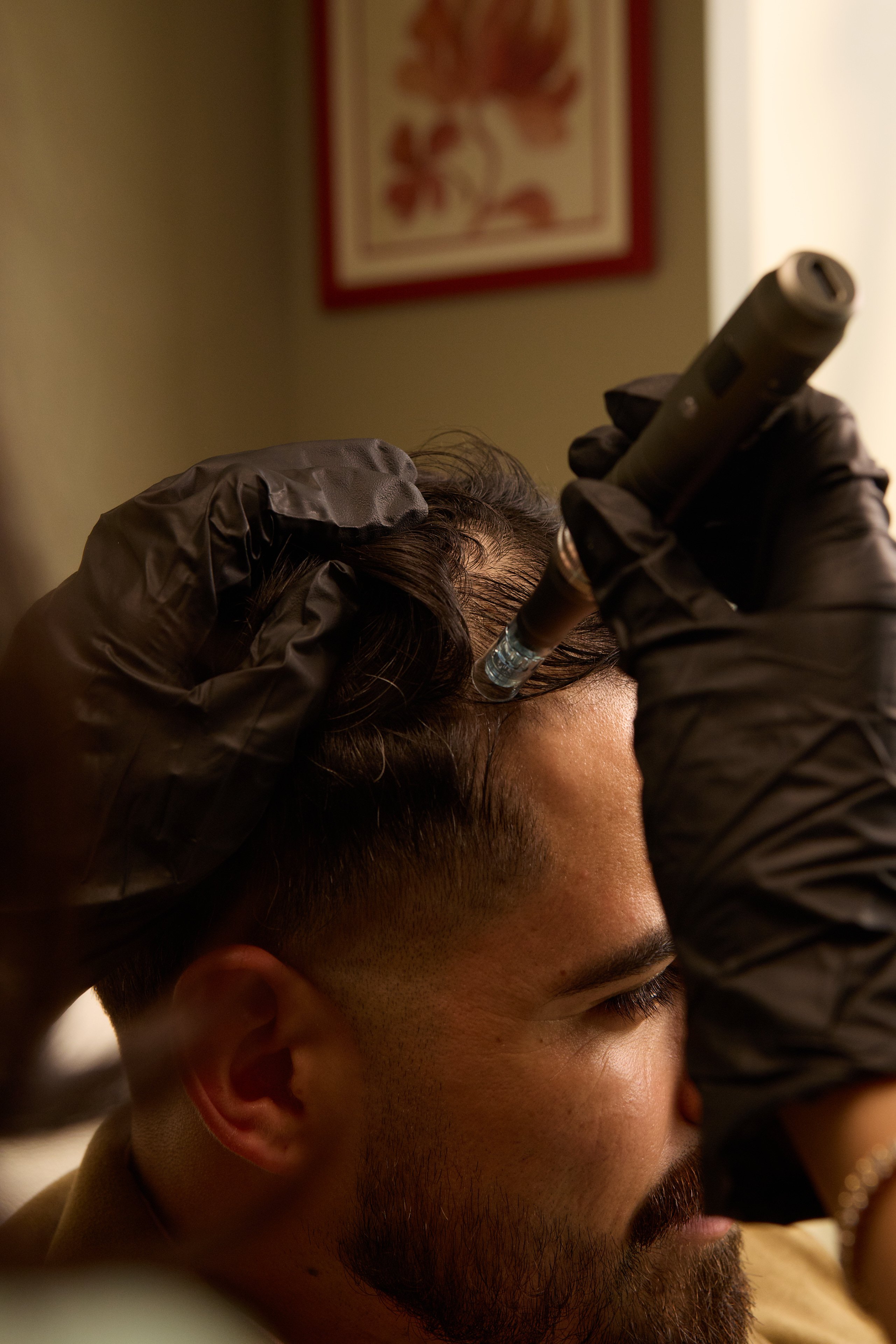 Close-up hair restoration treatment with a clinician using a precision device
