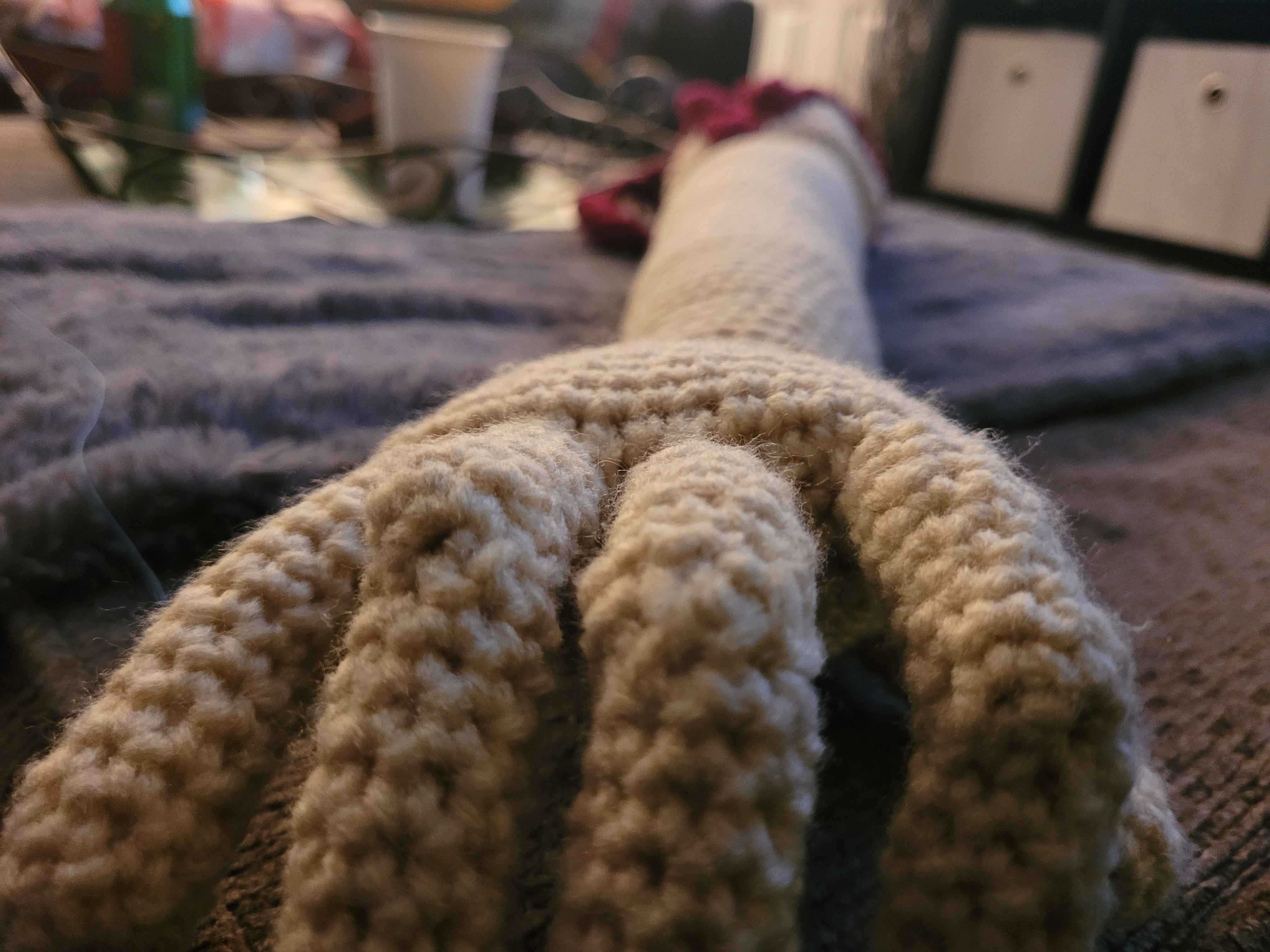 Wearable soft cosmetic arm being modeled