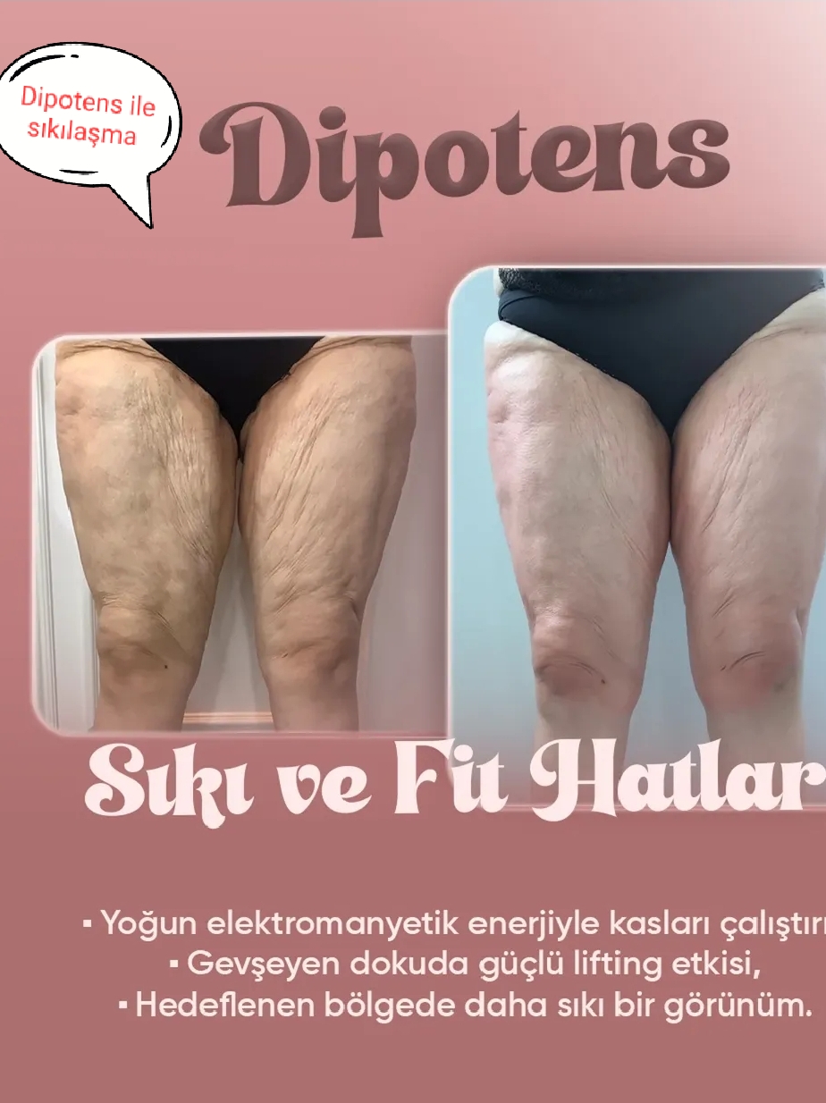 Dipotens Body Firming — Before & After 1