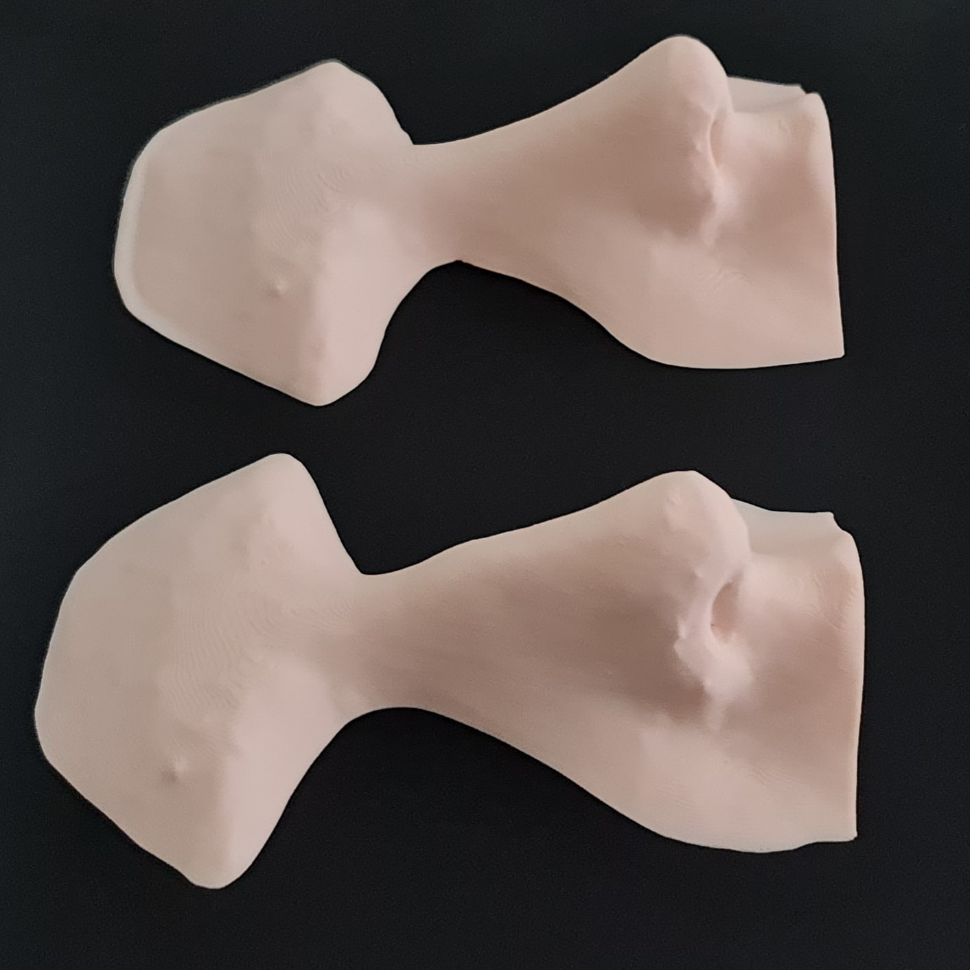 Burun estetiği simülasyonu