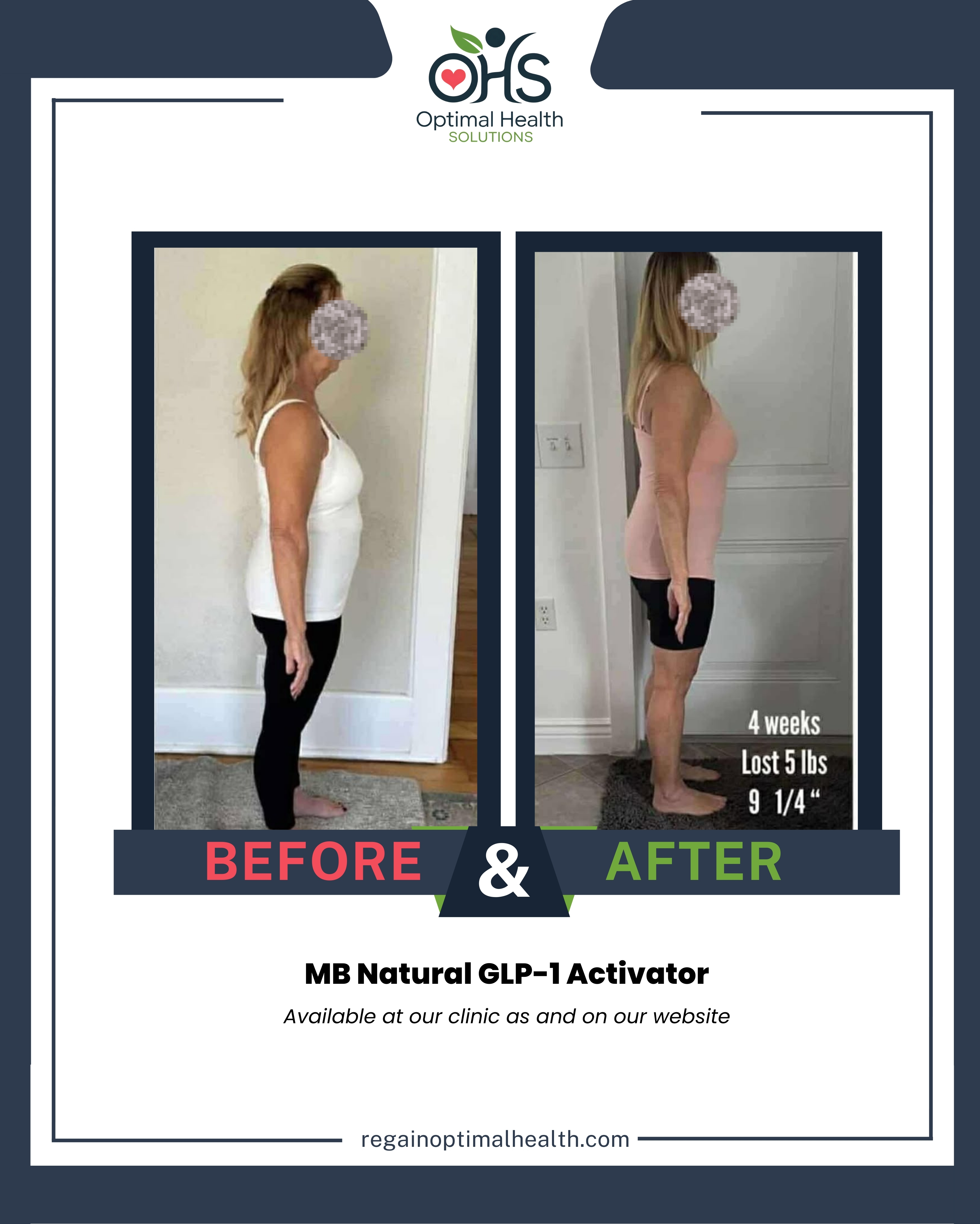 Patient feedback review 4 - Side profile transformation