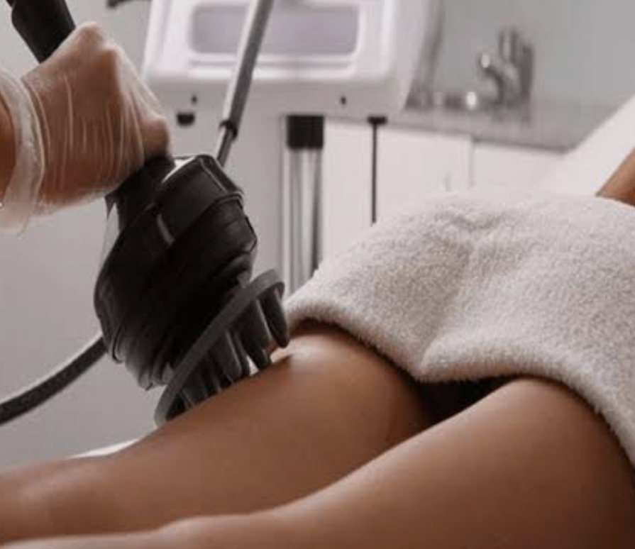 G9 Body Contouring & Cellulite — Before & After 1