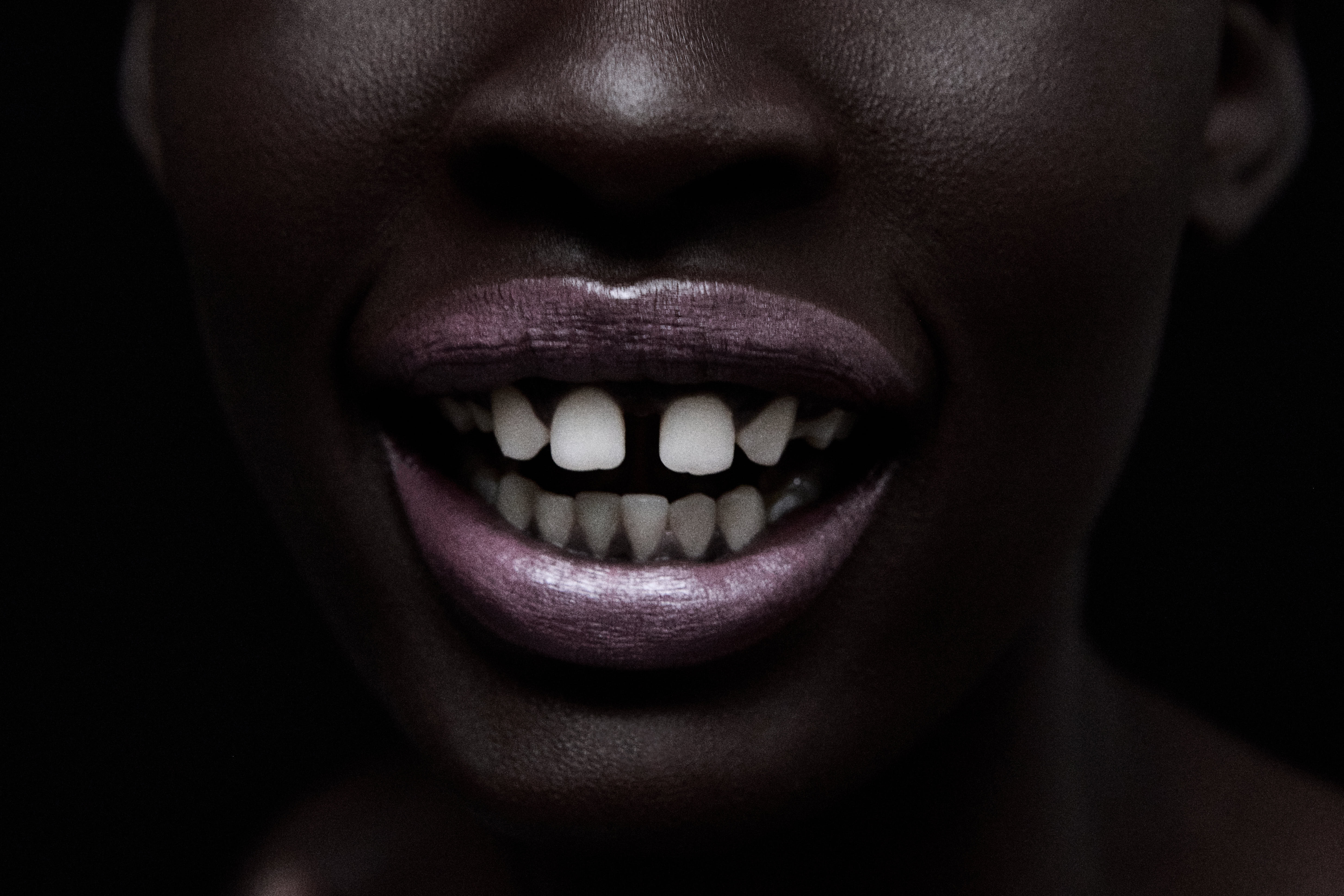 Landscape close-up of a smile with metallic mauve lips and a tooth gap
