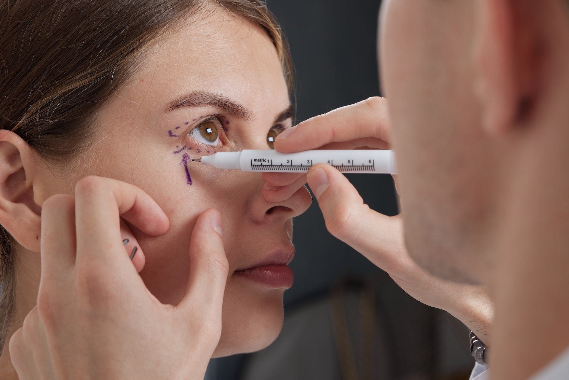 Imagen relacionada con Rinoplastia en Madrid