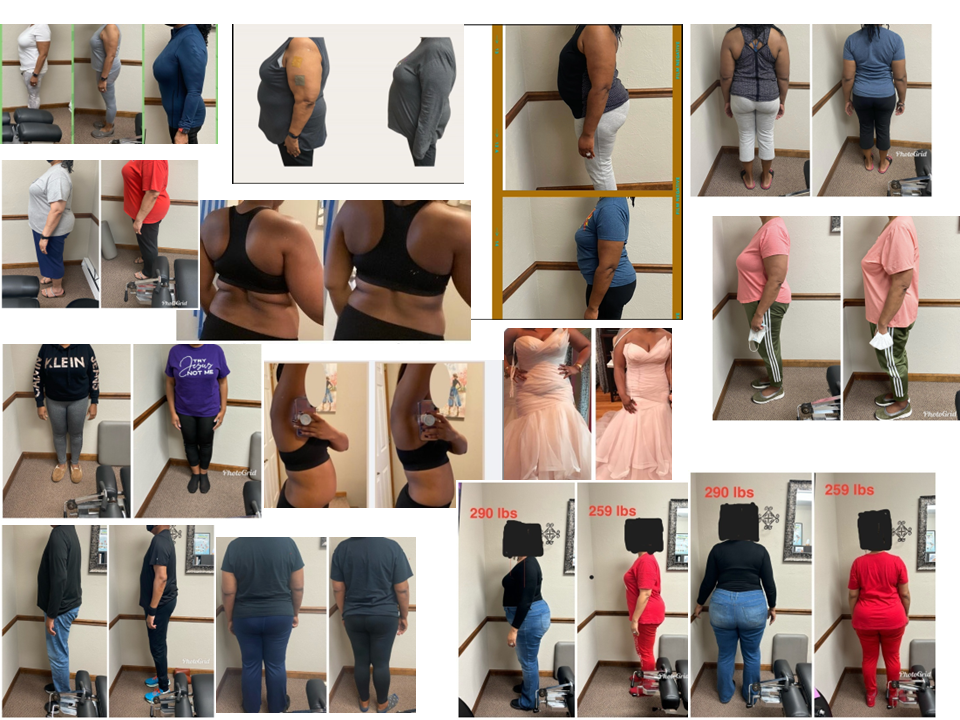 ChiroThin weight loss patient before and after transformations