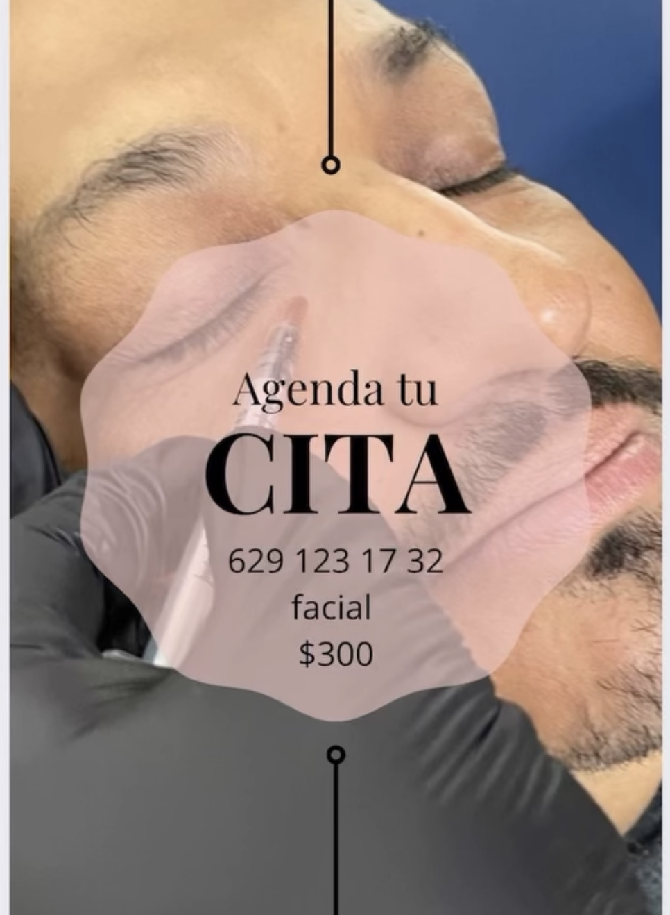 Facial