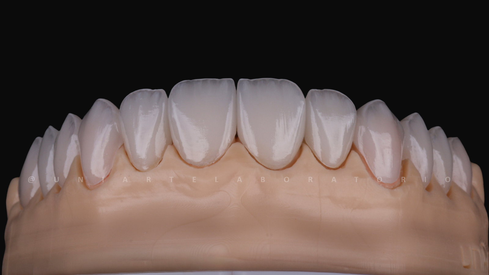 Lentes de Contato Dental - Uniarte