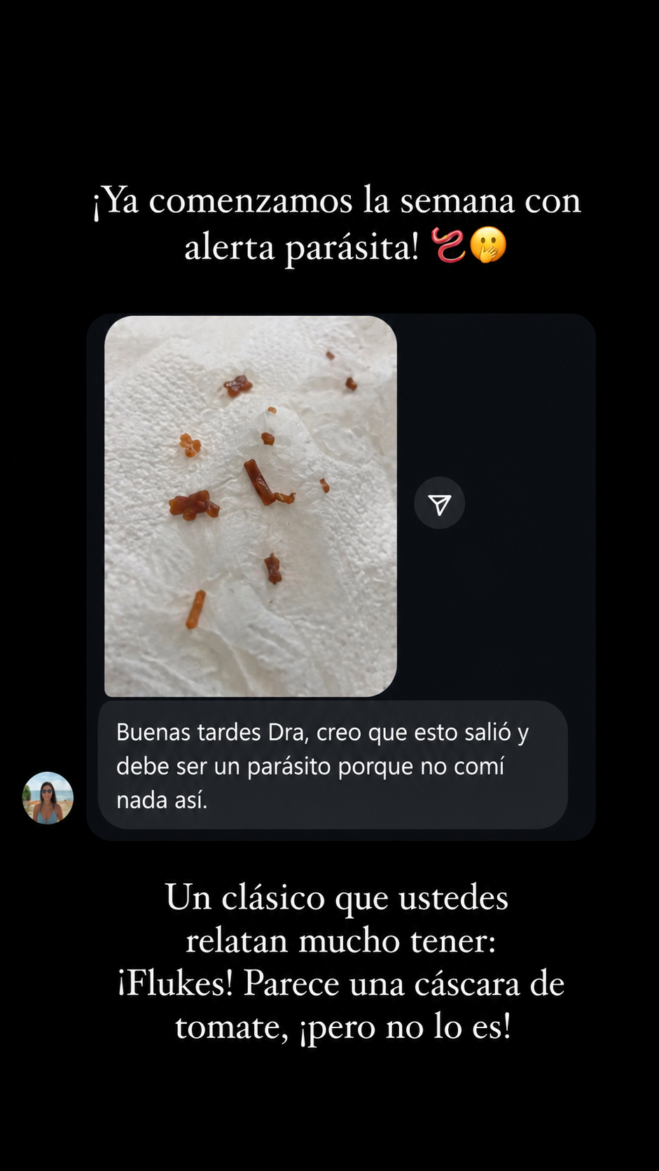 Testimonio de cliente con parásitos reales eliminados - flukes - alerta parásita
