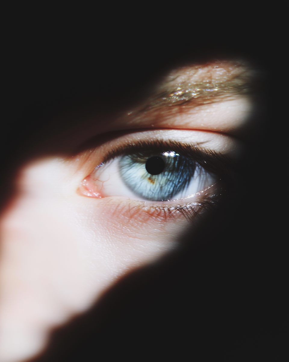 Glaucoma