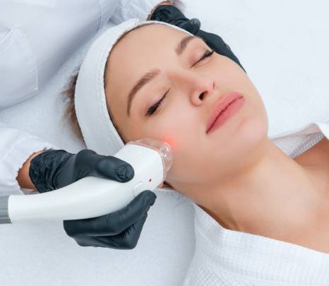 Faltenbehandlung mit Sculptra® (Polymilchsäure)