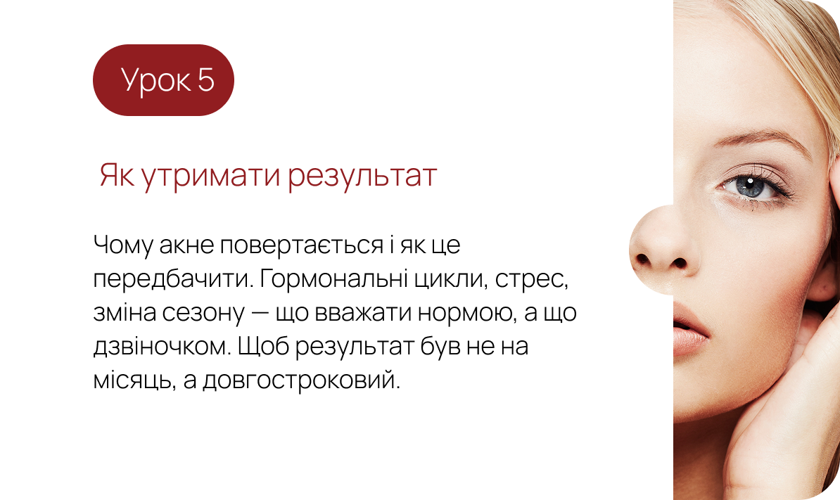 Урок 5. Як утримати результат — чому акне повертається і як це передбачити