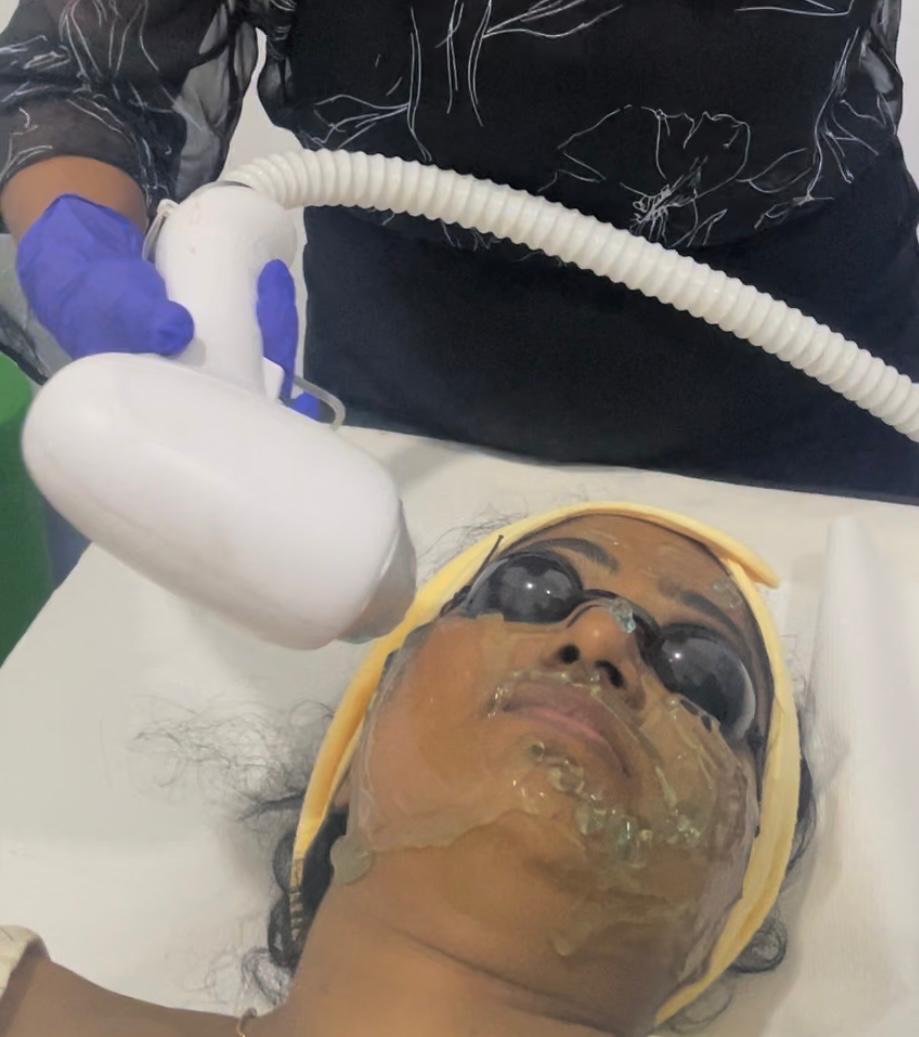 Laser Hair Removal - Professional aesthetic treatment at The Elite Derma Care, Nugegoda