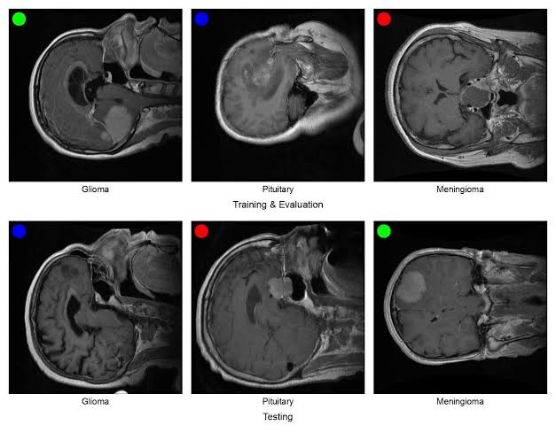 Six brain MRI examples grouped into training and evaluation above, and testing below