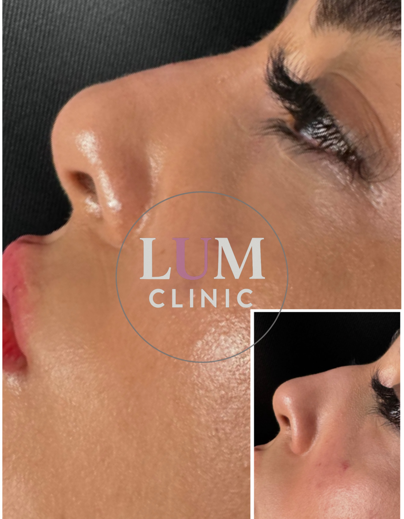 Lum Clinic Instagram post 1