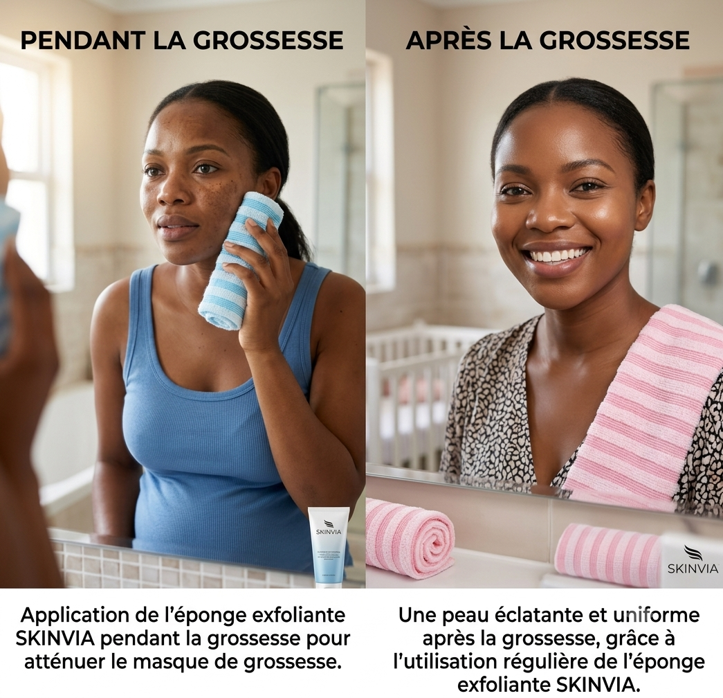 Comparaison pendant et après la grossesse avec l'éponge exfoliante SKINVIA