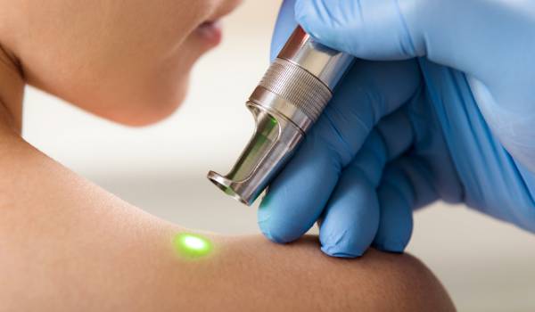 Laserbehandlung Berlin Kosten