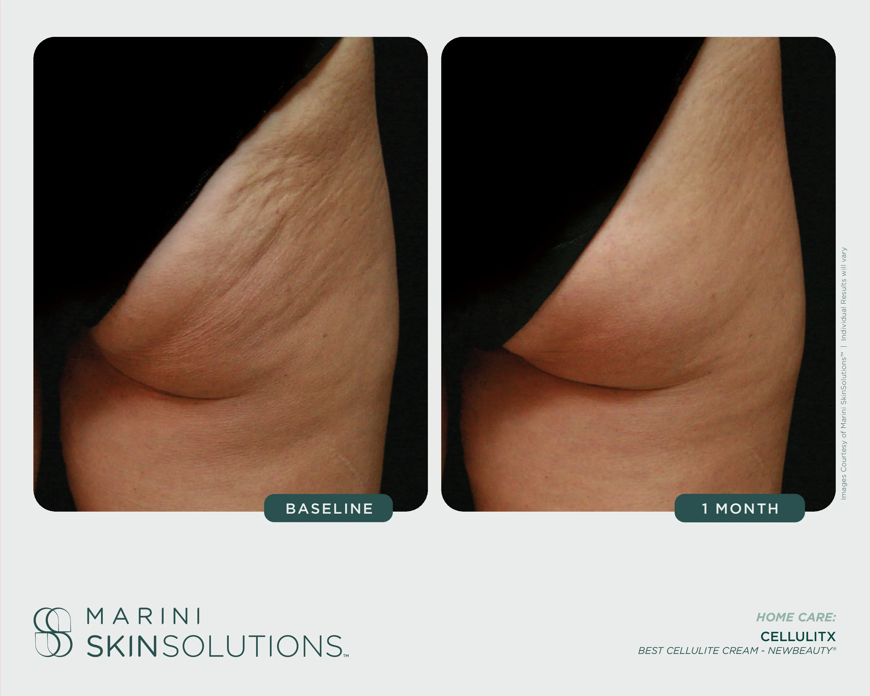 Wrinkles — Skin Care Management System + Retinol Plus