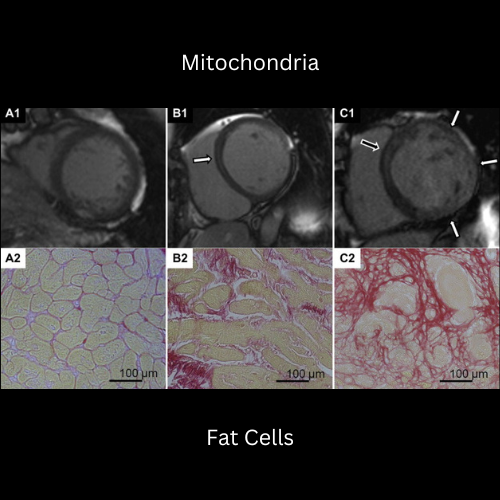 Microscope comparison of mitochondria and fat cells