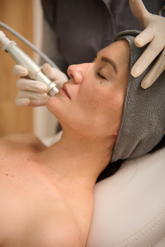 Tratamiento estético facial con dispositivo médico en Clínica Ohmio