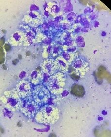 Muestra citológica - células teñidas violeta