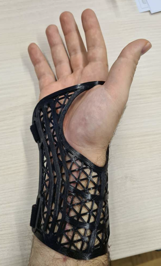 Wrist Stabilizer