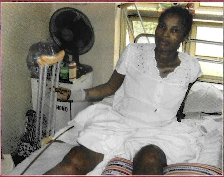 Female patient resting with newly received crutches
