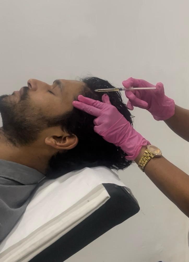 Hair Growth Treatment - Professional aesthetic treatment at The Elite Derma Care, Nugegoda