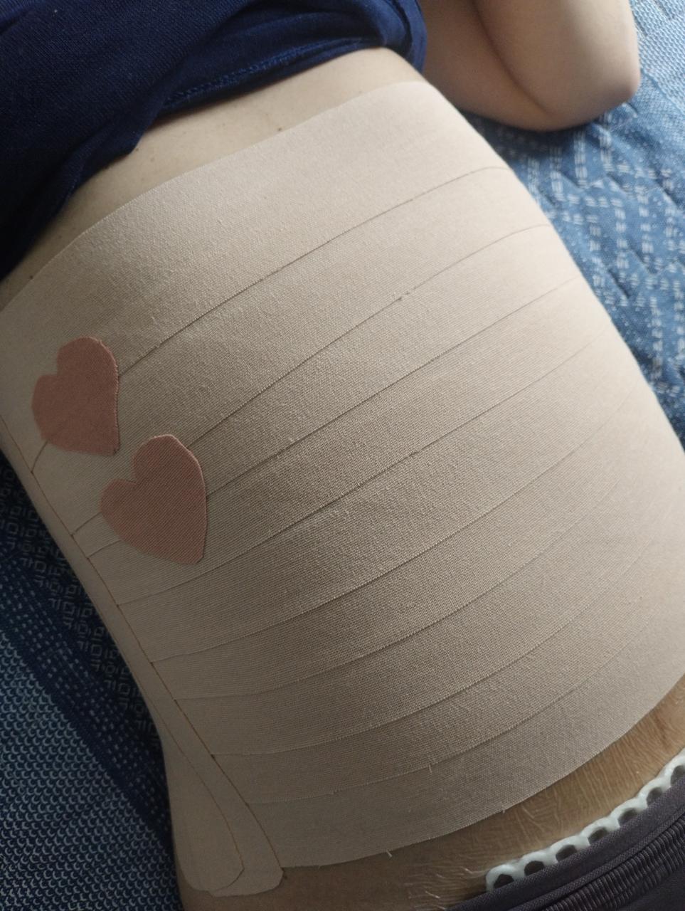 Taping abdominal pós-parto