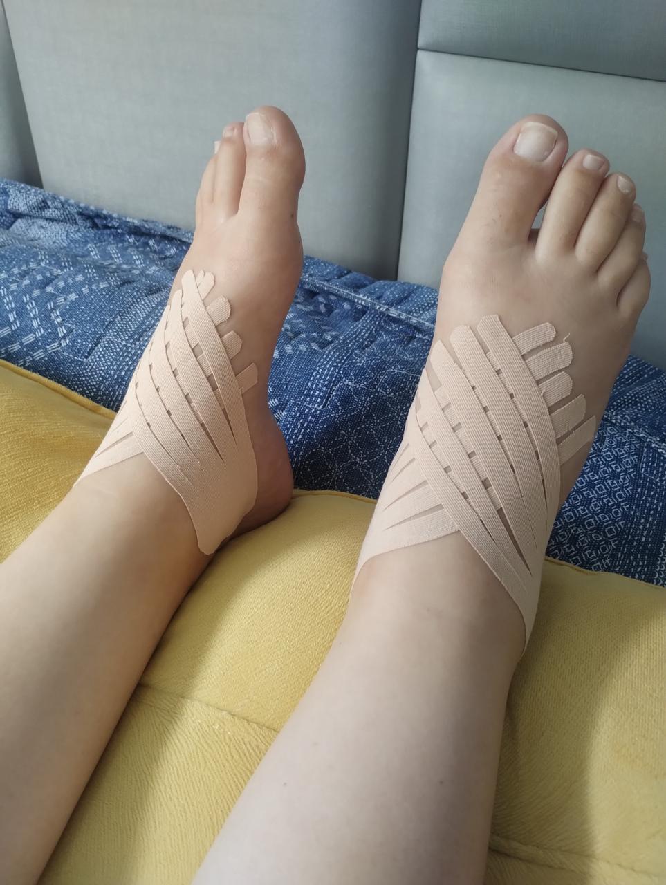 Taping nos pés para edema pós-parto
