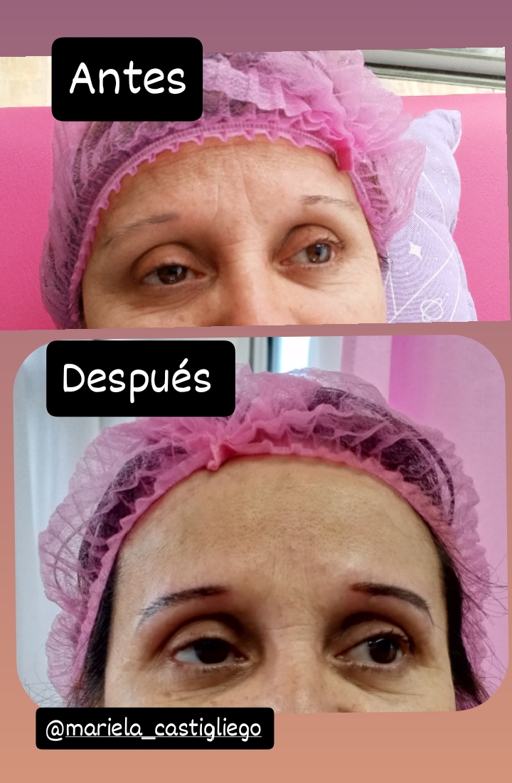 Micropigmentación de cejas - antes y después