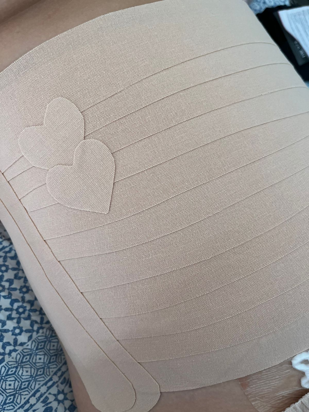 Taping abdominal com detalhes em coração