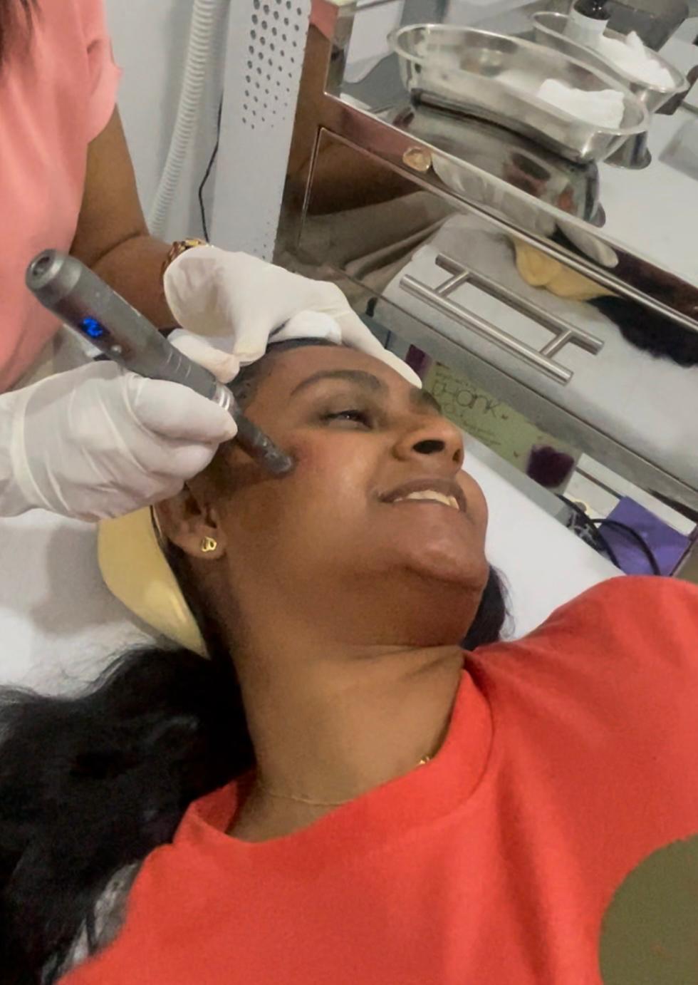 Acne Treatment - Professional aesthetic treatment at The Elite Derma Care, Nugegoda