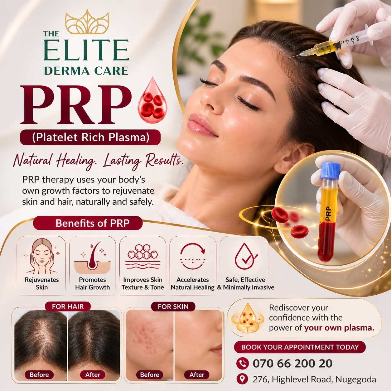 PRP Therapy - Professional aesthetic treatment at The Elite Derma Care, Nugegoda