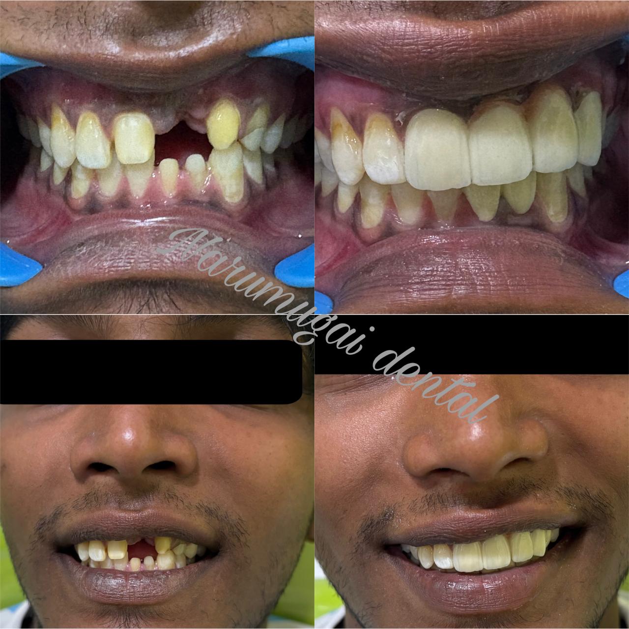 Dental case photographs provided by Narumugai Dental