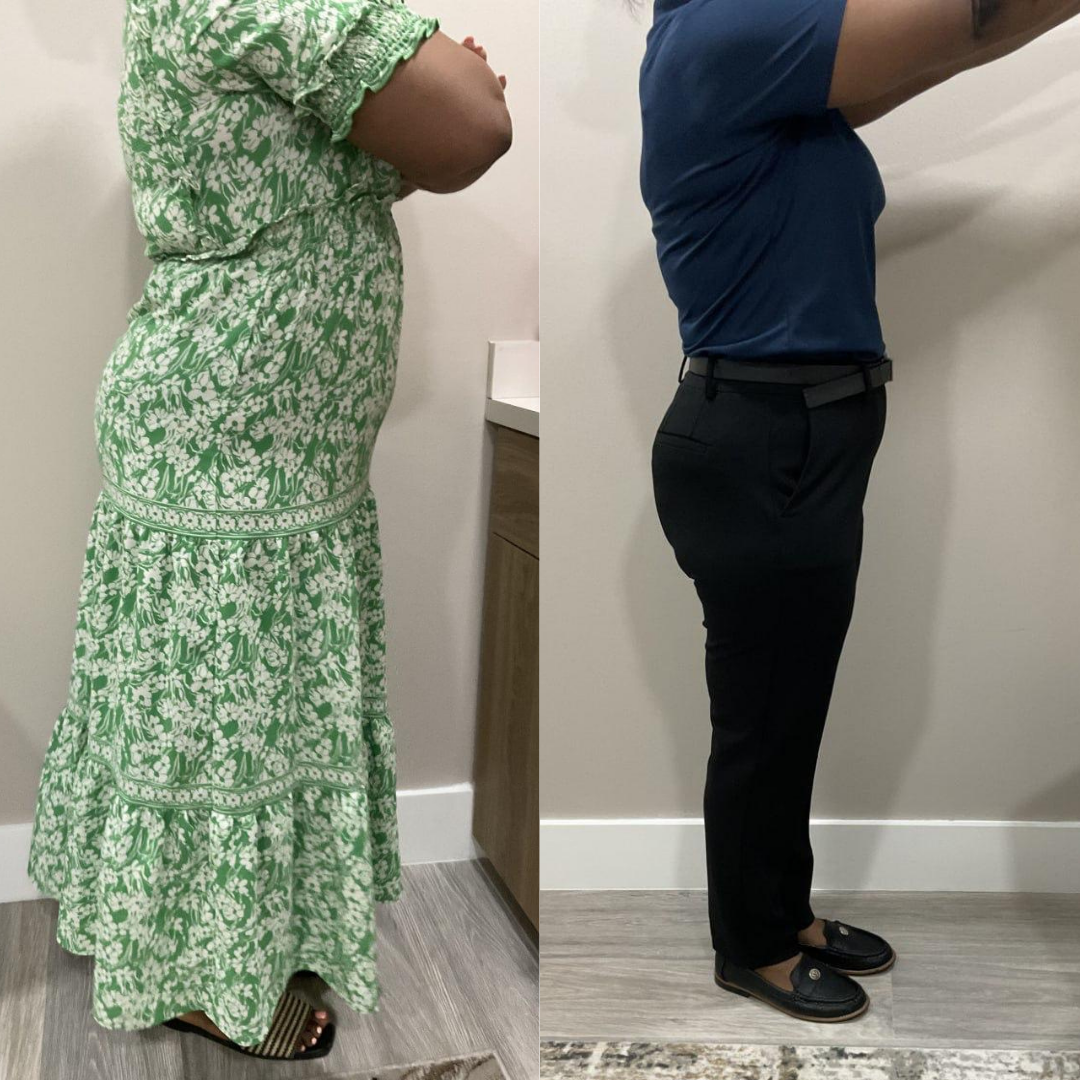 Wynnfern - Before and After Transformation