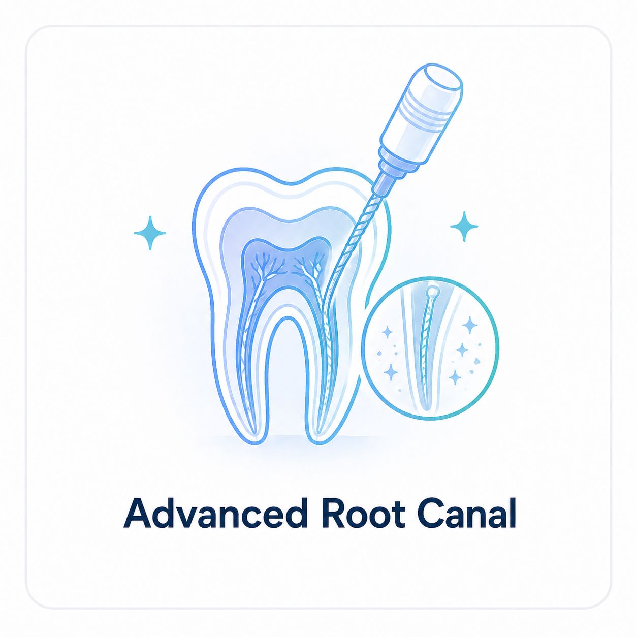 Advanced Root Canal