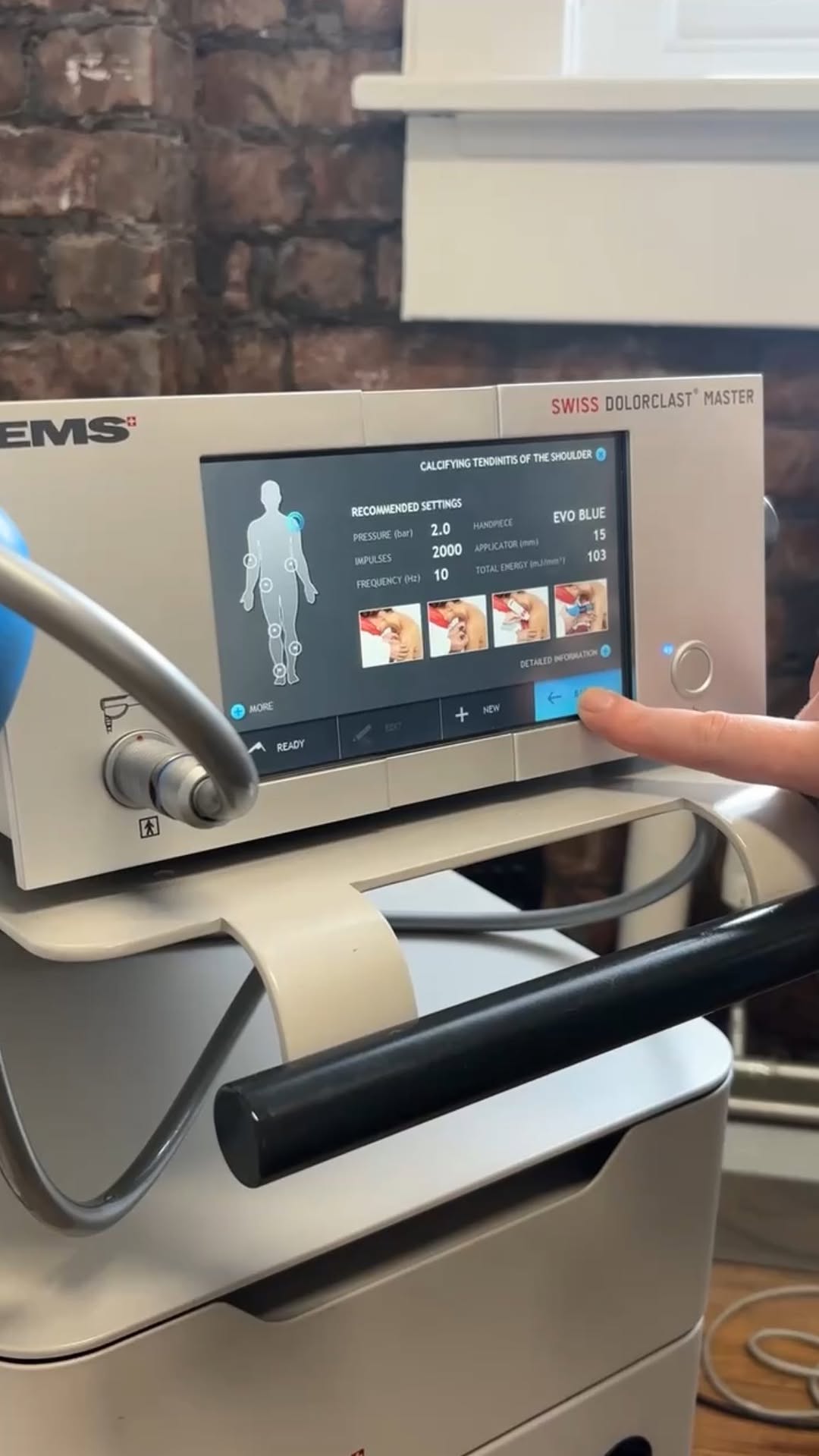 Swiss Dolorclast shockwave therapy machine used at City Chiropractic clinic