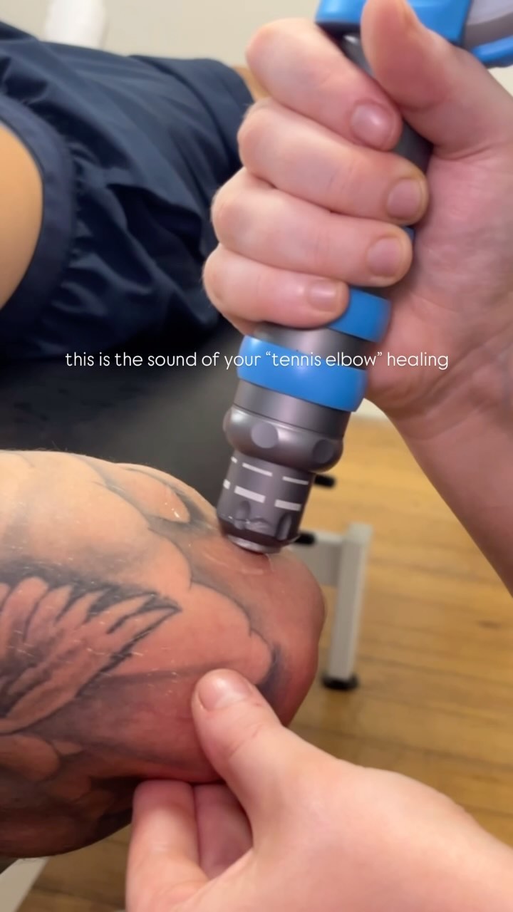 Instrument-assisted soft tissue therapy being applied at City Chiropractic