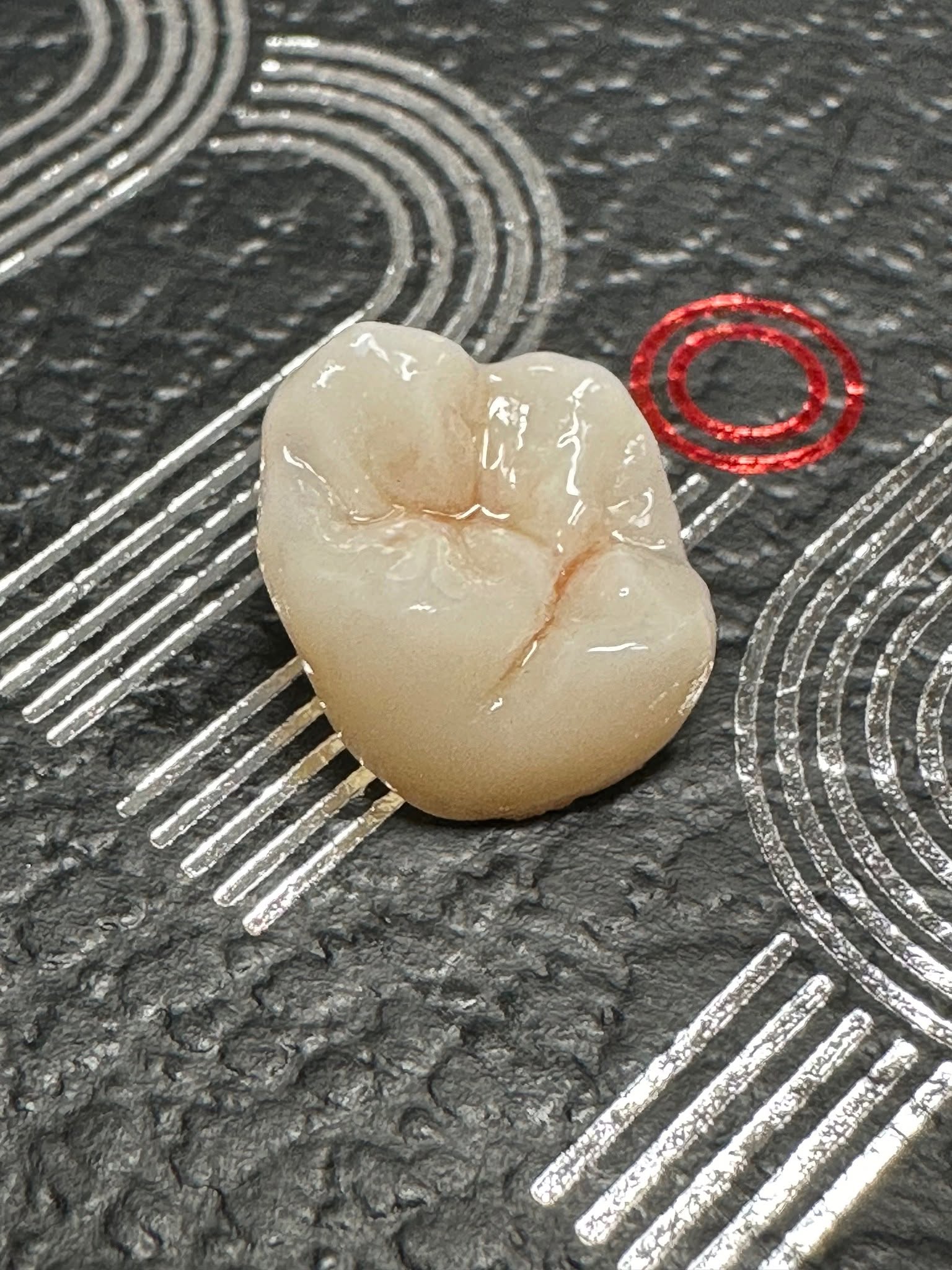 Close-up of a high-quality ceramic dental crown — precision dental craftsmanship