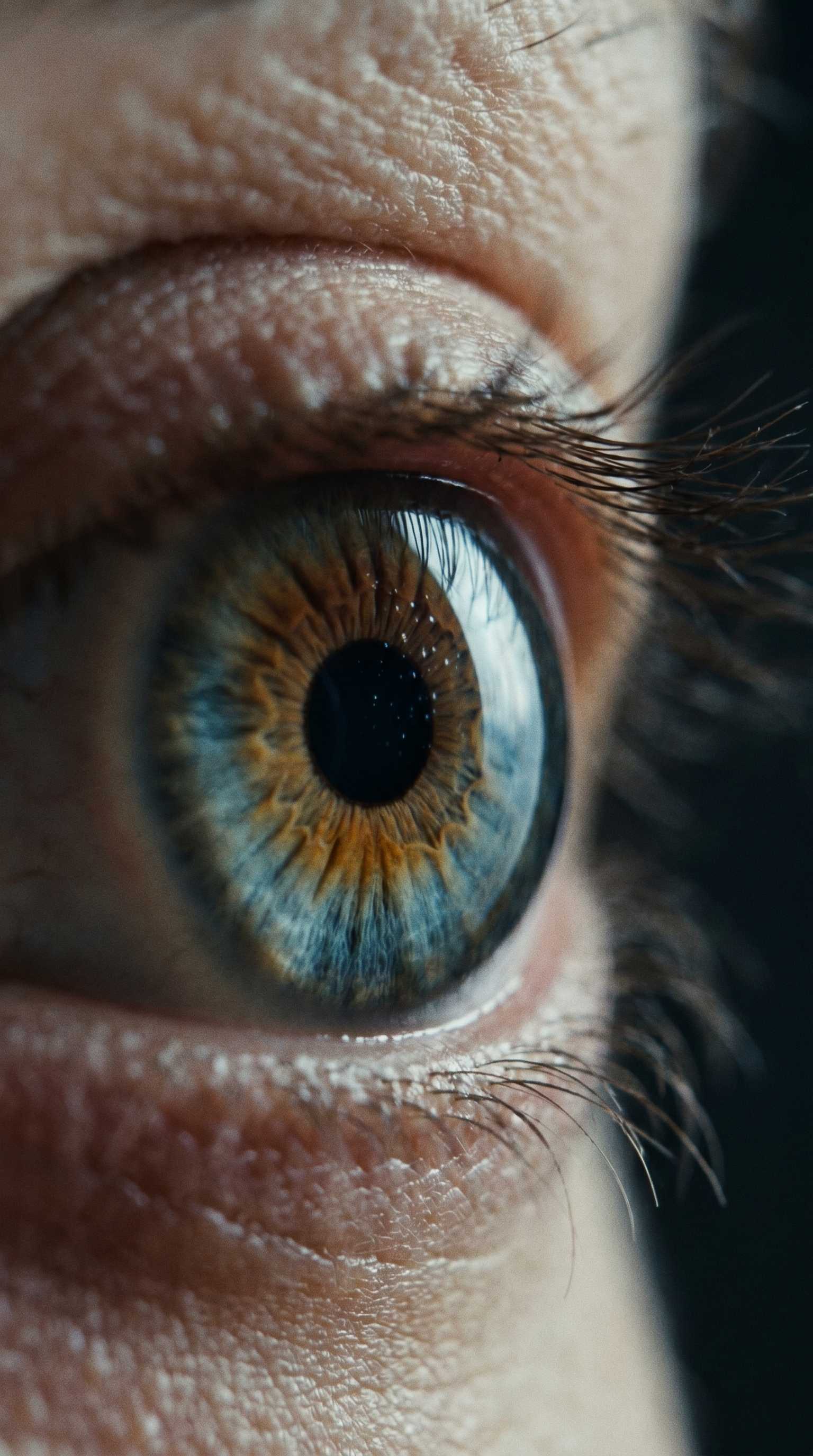 Eye static
