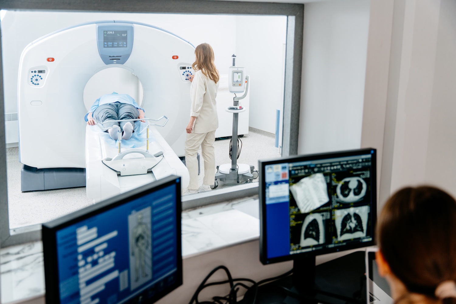 CT scan monitoring