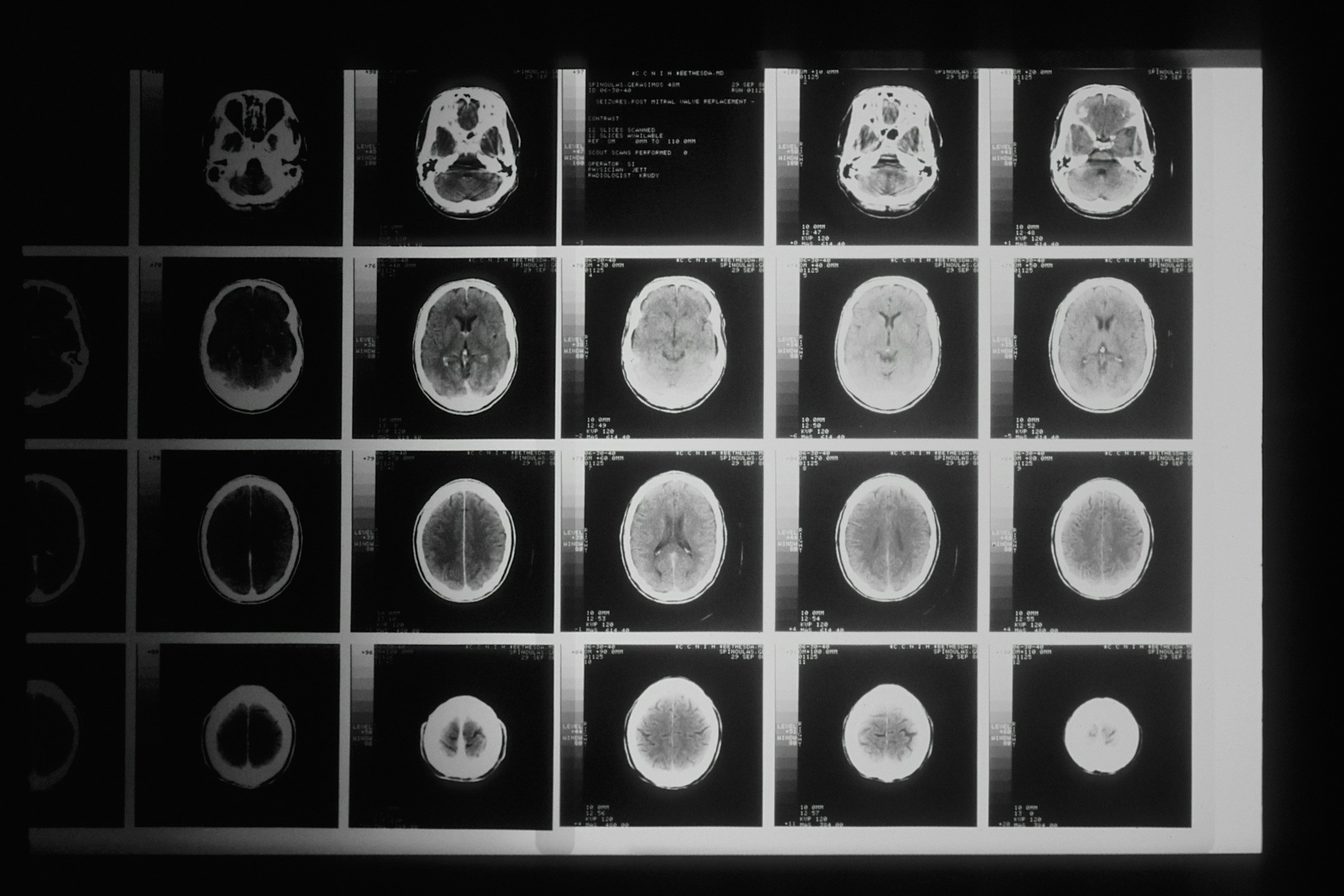 Grid of brain CT and MRI scans showing diagnostic imaging