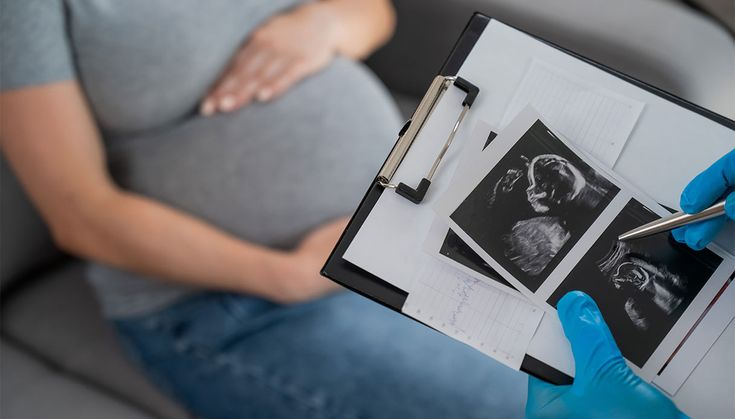 Doctor reviewing ultrasound images with a pregnant patient