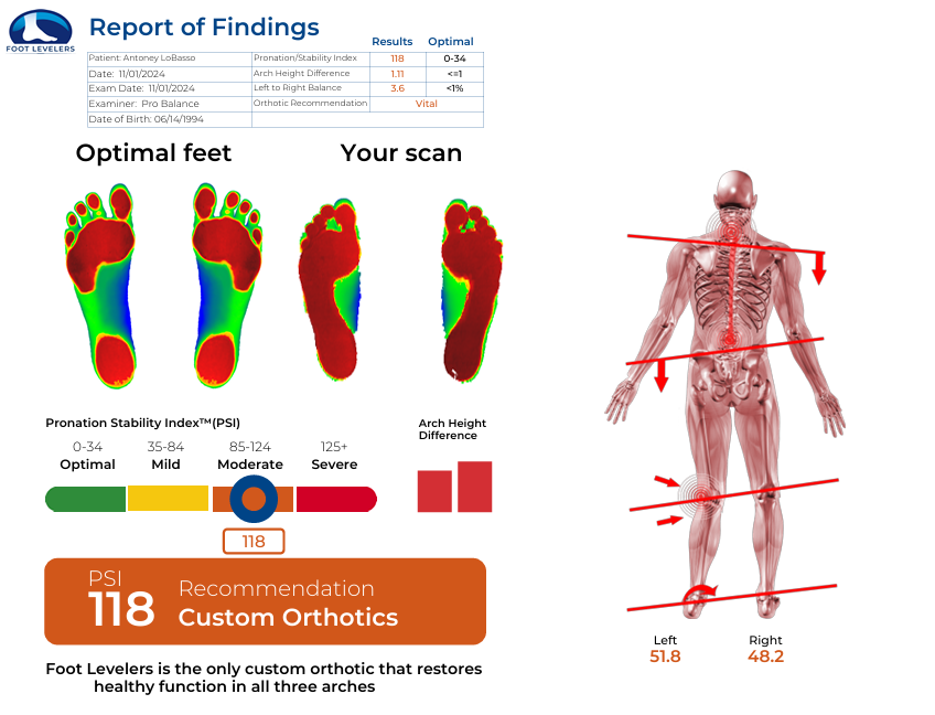 Foot Levelers Report of Findings with pronation stability index scan results and orthotics recommendation
