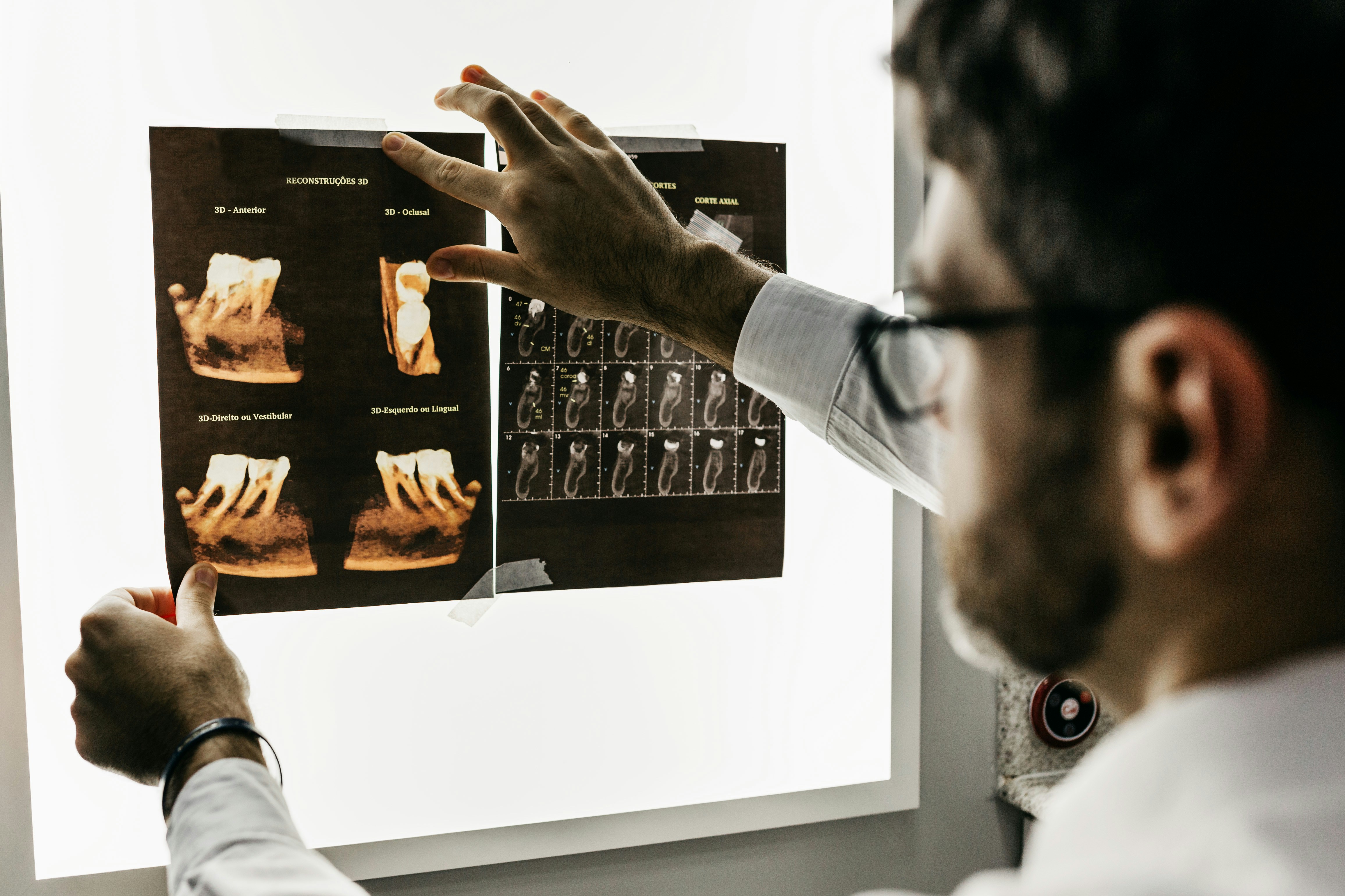 Medical professional examining x-ray images