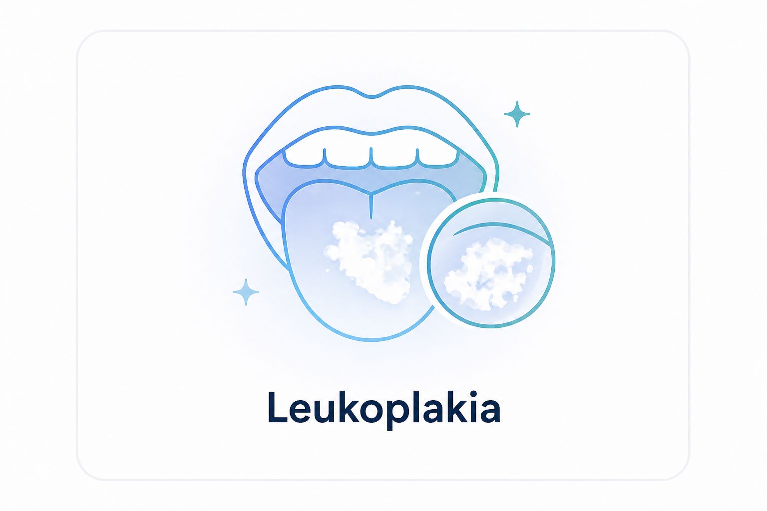 Leukoplakia